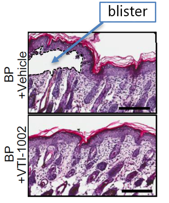 No blistering was observed in a mouse model of pemphigoid    diseases that was topically treated with granzyme B inhibitor (VIT-1002).